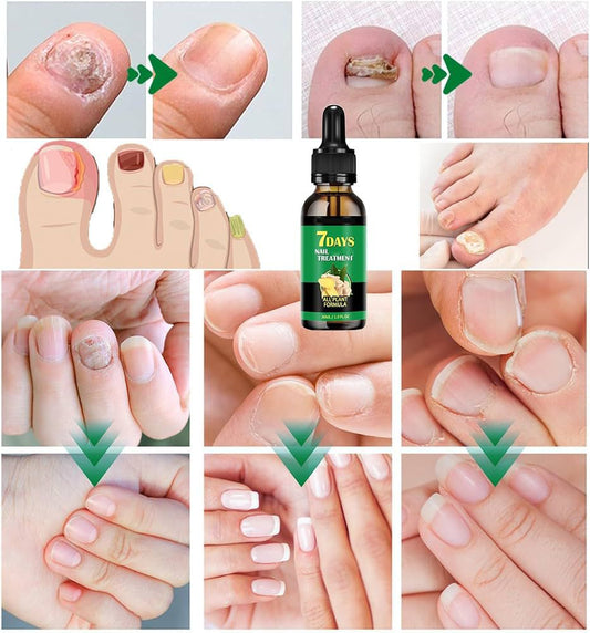 Retrouvez des Ongles Sains, Lisses et Forts en Seulement 7 Jours