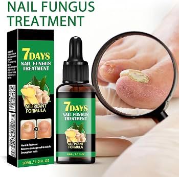 Retrouvez des Ongles Sains, Lisses et Forts en Seulement 7 Jours